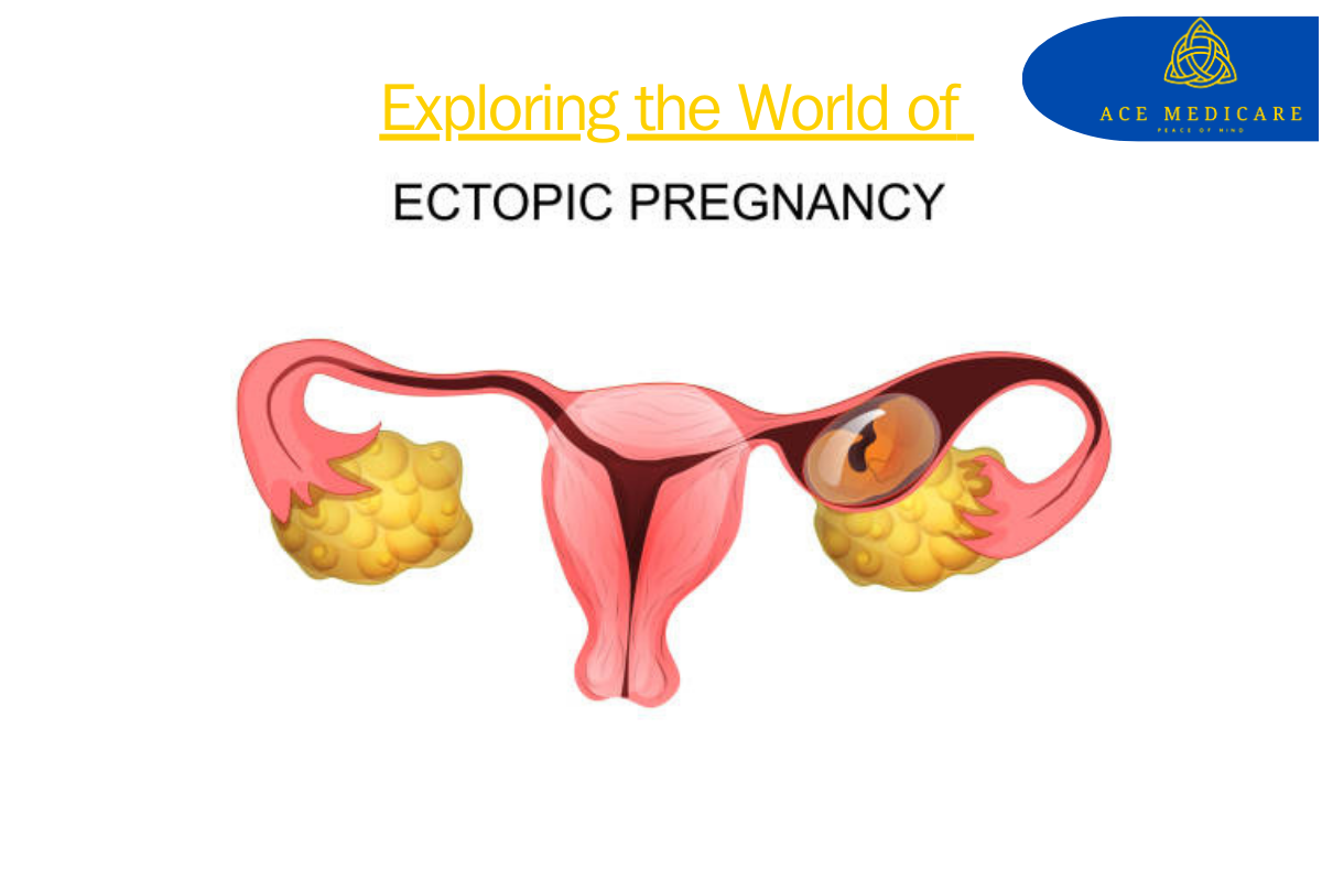 Exploring the World of Ectopic Surgery: Asthai Garbhashay and its Surgical Solutions